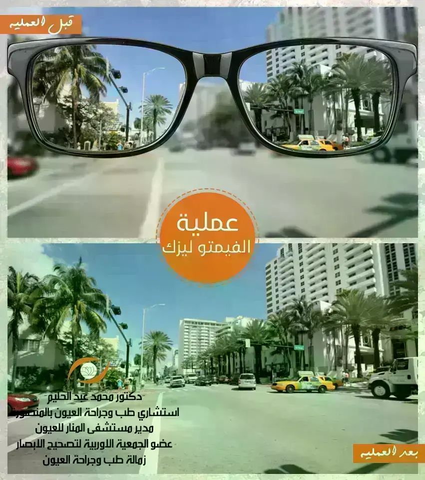 دكتورعيون محمد عبد الحليم -إستشاري طب وجراحة العيون 2